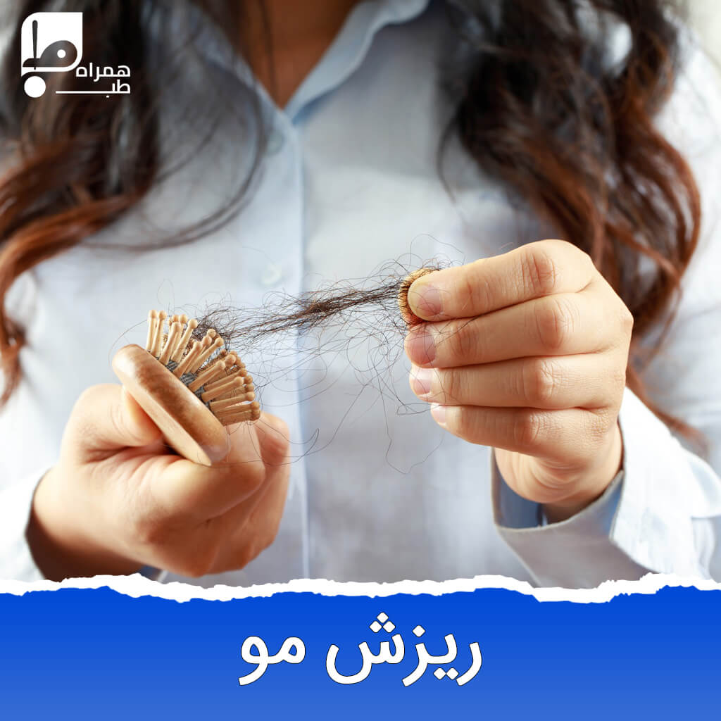 علت ریزش مو