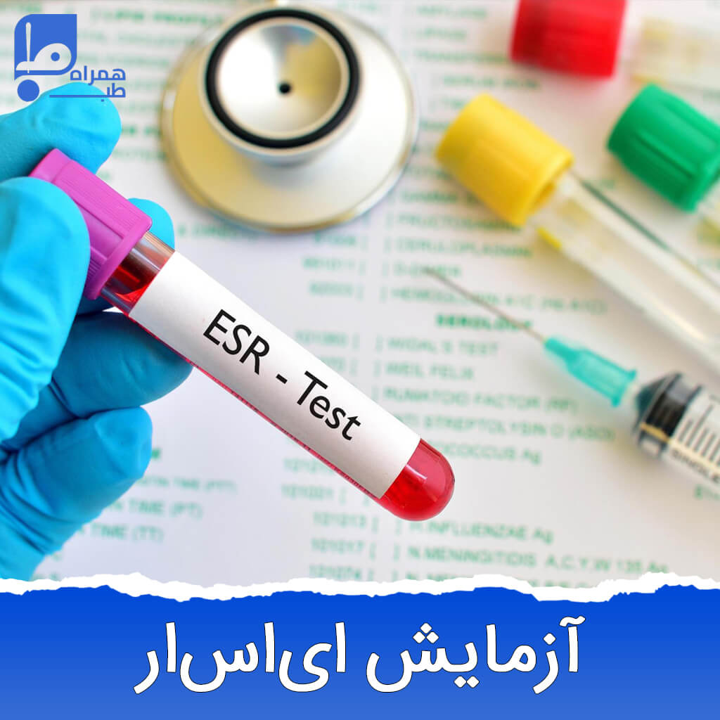 ای اس آر چیست