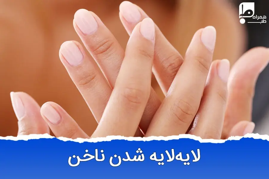 علت لایه لایه شدن ناخن