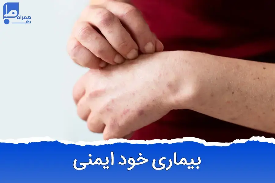 بیماری‌های خودایمنی: رازهای ناشناخته، خطرات پنهان و راه‌های درمان