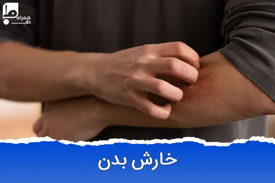 چرا بدن می‌خارد؟ از دلایل ساده تا نشانه‌های خطرناک