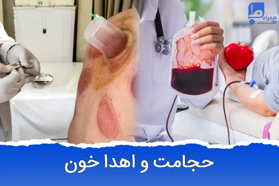حجامت یا خون دادن: کدام یک برای سلامت شما مفیدتر است؟